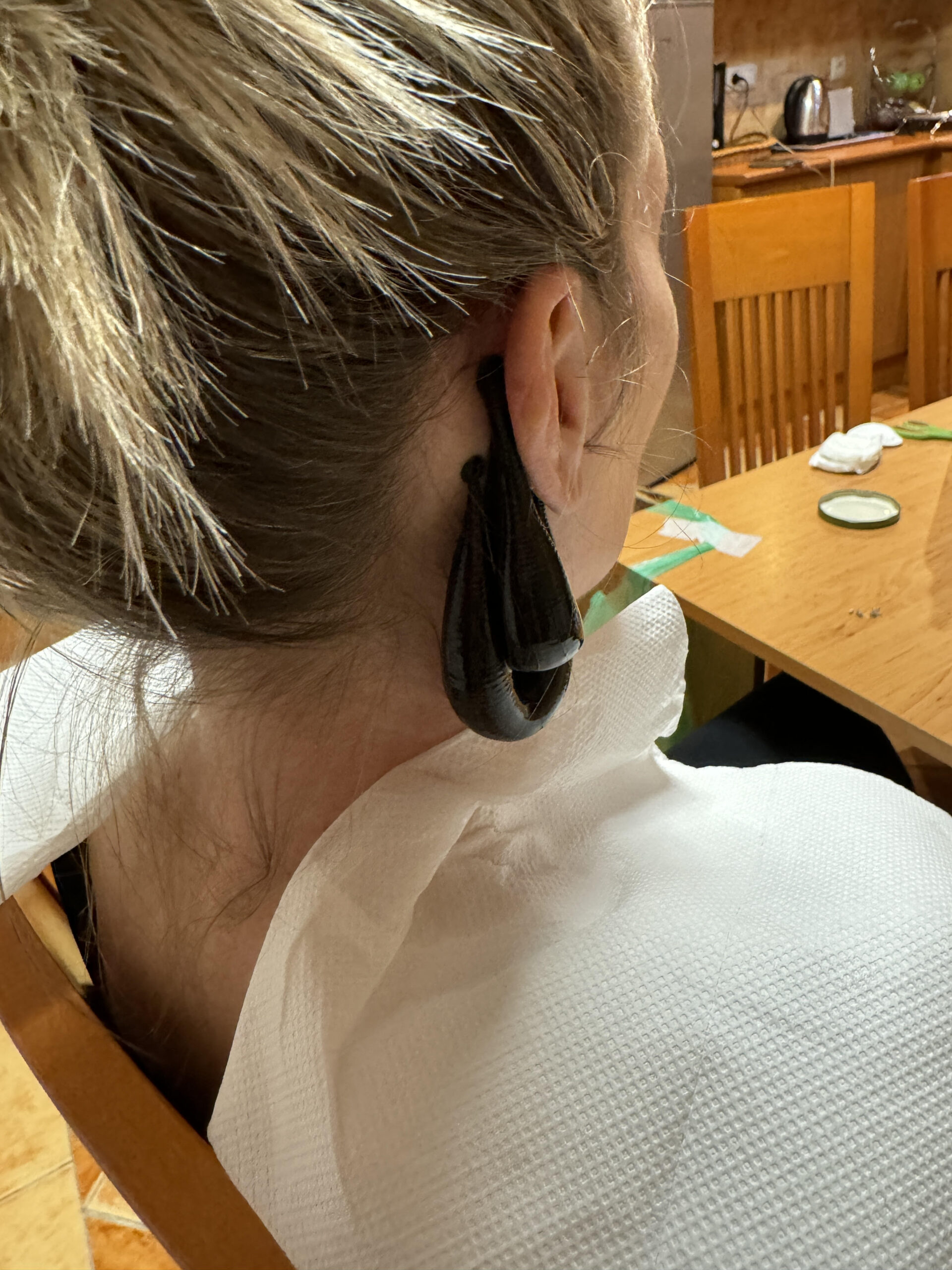 Piócás kezelés fülzúgásra