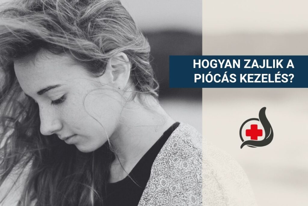 hogyan-zajlik-a-piocas-kezeles